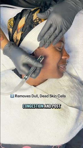 What is microdermabrasion? Great exfoliation for the skin. Here’s why! #skincaretips