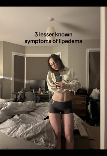 #lipedema