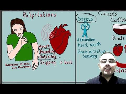 Palpitations vs Arrhythmias; What is the most common cause of palpitations?