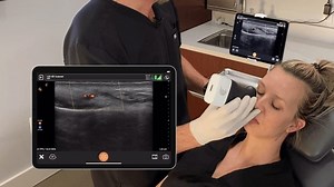 Facial Aesthetics: Vascular Mapping | Clarius