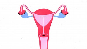 12% of American women using birth control use an IUD. We explain what it is, and why it's one of the most effective birth control methods. Janelle Monáe narrates our miniseries Sex, Explained. Stream it now on Netflix: netflix.com/sexexplained. | Vox