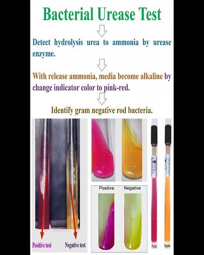 Bacterial Urease Test #geneticteacher