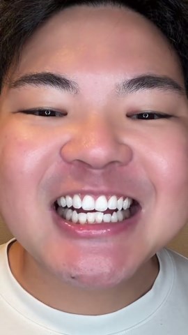 コスパ最強の歯を白くする方法