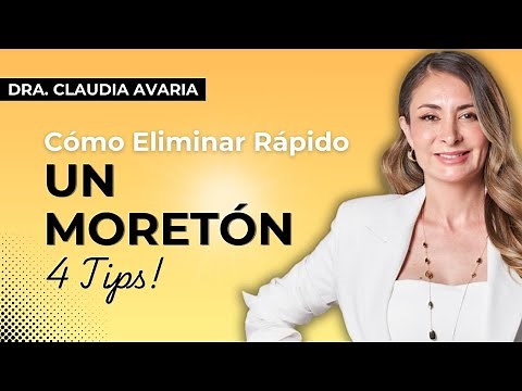How to Get Rid of a Facial Bruise in Record Time - 4 Tips