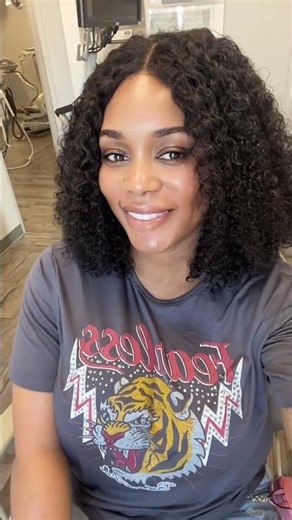 Cosmetic Dentistry Transformation: A Stunning Smile Makeover#cosmeticdentistry