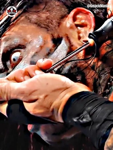 WWE OMG Moments Extreme Compilation 😱 | Roman Reigns #wwe #romanreigns #stonecold