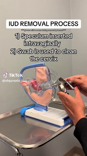 IUD Removal Process Explained: What Happens During Removal