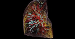 World's brightest X-rays usher in medical imaging revolution