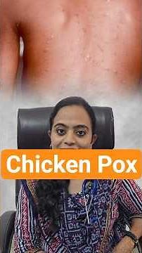 Chickenpox (சின்னம்மை) – Complete Guide for Parents | Symptoms & Treatment - Dr. Fouziya MD Paeds