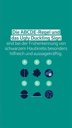 Schwarzer Hautkrebs: Die ABCDE-Regel und Ugly Duckling Methode einfach erklärt