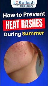 Heat Rashes or Allergy? Here's what to do! | Skin Specialist explains | Kailash Hospital Sec71 Noida