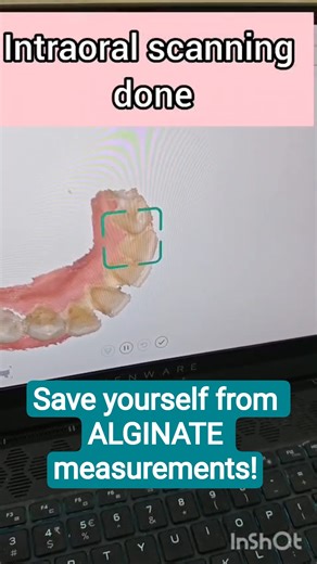 Goodbye Alginate! Hello Digital Intraoral Scanning 🦷 #future #dentist