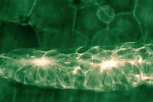 Zebrafish lateral line | 2014 Small World In Motion Competition