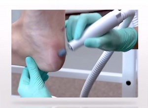 Originating from the Latin words ‘pedis’, meaning ‘of the foot’, and ‘cura’ meaning ‘care’, a pedicure is a cosmetic treatment of the feet. It’s not just all about painting your nails, in fact, that is not necessary at all. A pedicure is a comprehensive treatment of your feet and is suitable for both men and women. It involves cutting, trimming and shaping your toenails, tending to your cuticles, exfoliating, hydrating and massaging your feet, and, if desired, painting your toenails. Why have a 