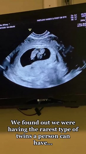 Our story with our two sets of twins!!! 🤍🤍💗💗💙💙 #twins #twinboys #twosetsoftwins #twingirls #twinflame #twinfamily #twinsoftiktok #quadruplets #identicaltwins #doubledosetwins #momotwins #twinsbychance #gerberbaby #pampers #huggies #trending #fypシ #foryou #fyp #foryoupage #viral #famous #love #funny #cute #foryoupage #viralvideo #duet #twintok #crazy #viral #crazytok #mysterious #albatwins #albafamily #trend #dance #twintiktok #husbandgoals #familytok #todayshow #todayparents #goodmorningam