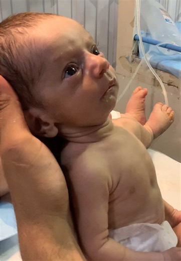 Cute Baby Little Cough Moment 👶💗 So Adorable. This cute newborn baby little cough moment is both adorable and precious. 👶💞 Babies often make small sounds like coughing or tiny reactions while adjusting to their new environment. These little expressions are part of normal newborn behavior and make baby moments even more special. Watching this sweet baby’s innocent reaction is simply heart-melting. 💗 #adorable #baby #shorts #nicu #viral