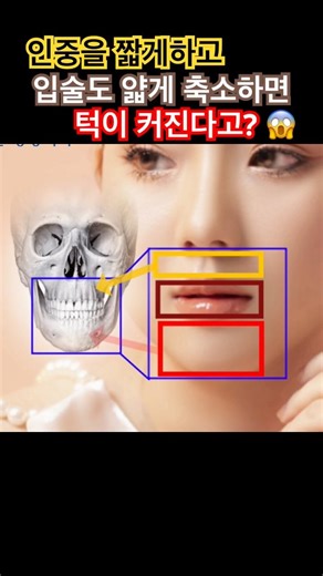 [인중축소+입술축소] = 안 예쁜 해부학적 이유