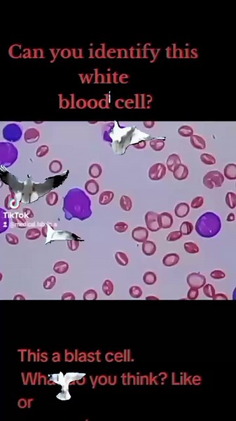 Medical Lab in a minute (@medical.lab.in.a)’s videos with original sound - Medical Lab in a minute