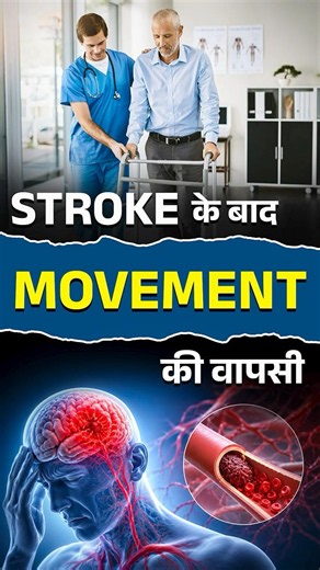 Stroke के बाद Movement की वापसी🚶| Movement Recovery After Stroke