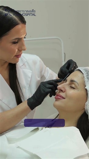 Rhinoplasty isn’t surface-level reshaping. It’s structural nasal surgery. 🏥✨