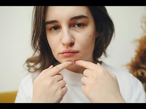 How to Get Rid of Pimples in 5 Easy Steps 🌟 | Simple Tips for Clear Skin