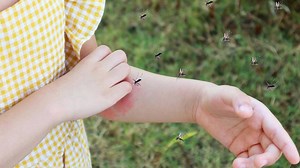 मच्छर काटने से हो जाते हैं खुजलीदार दाने? डॉक्टर से जानें इससे बचने के आसान तरीके