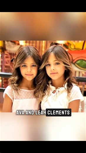 These twins defy genetics, logic, and history. Some look nothing alike. Others lived longer than anyone ever thought possible. Some are so identical, they share the same life. Which one is the most unique to you? #RareTwins #HumanMysteries #IncredibleStories #DidYouKnow #MindBlown | StrangerealityHub | Facebook