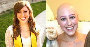 ‘I’ll only play if you take your wig off.’ I was shocked and hurt. I let her bully me in my own house.’: Woman advocates for girls with alopecia, ‘Bald is beautiful’