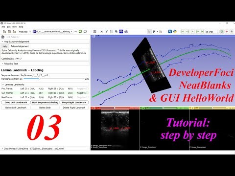 Developer / Slicer Area, Neat Blanks, GUI HelloWorld -- 3D Slicer Extension Development Tutorial #03