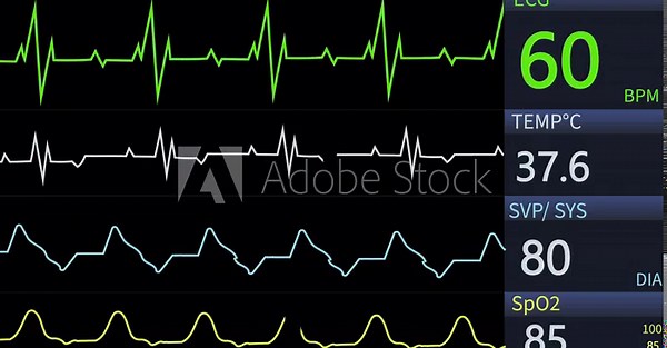 Animated video of a patient monitor screen displaying vital sign values, including heart rate, blood pressure, oxygen saturation, and respiratory rate. Healthcare, medical monitoring technology. 4k