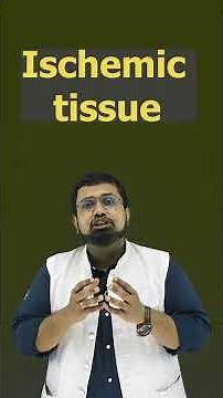 Ventricular Tachycardia