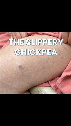 Dr Pimple Popper vs The Slippery Chickpea