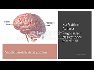 Syphilis; neurosyphilis