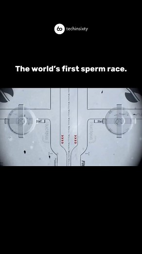 World’s First Sperm Race – April 25, 2025, Los Angeles Key Details: Event: Two sperm samples — Tristan (USC) vs. Asher (UCLA) — raced on a microfluidic chip mimicking the female reproductive tract. The race was broadcast live via high-resolution cameras. Venue: Downtown Los Angeles movie set (originally planned for the Hollywood Palladium). Setup: 20-centimeter-long track. Sperm swimming speed: ~5 mm/min. Race duration: ~40 minutes. Synchronized start with chemical cues guiding the sperm. Purpos