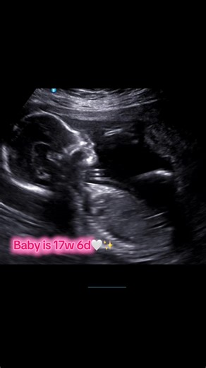 17 Week Baby Ultrasound: Growing Strong Heartbeat