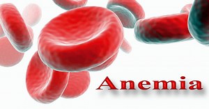 Iron Deficiency Anemia and Hashimoto's- Understanding your Iron Labs