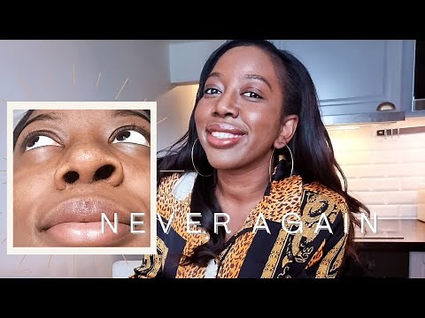 Why I REGRET my botched Nose job