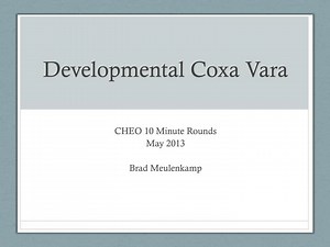 Developmental Coxa Vara - SlideServe