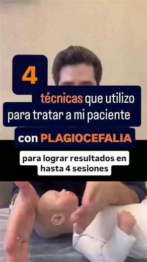 Icaro Ramalho | Método TMAP on Instagram: "🟡 Fisioterapeuta, ¿quieres tratar la plagiocefalia de forma eficaz y en hasta 4 sesiones? Las técnicas del TMAP son indispensables para promover la simetría craneal. En este video te mostraré 4 abordajes fundamentales que utilizo en todos mis pacientes con plagiocefalia. Soy Ícaro Ramalho, fisioterapeuta especializado, y mi objetivo es ayudarte a convertirte en una referencia en pediatría. Aquí en mi perfil enseño cómo tratar disfunciones pediátricas c
