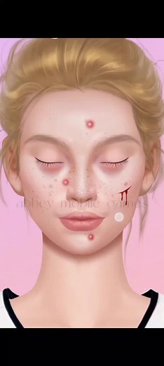 Ultimate Pimple Popping Game for Satisfying Skincare Fun