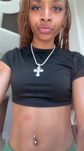 it’s a mosquito bite!! #bend #htx | Mosquito Bite