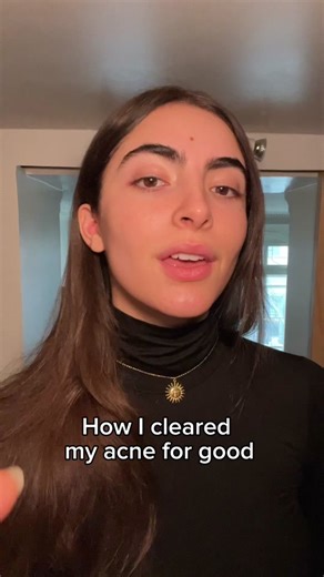 after years of struggling with acne, I am so grateful to have finally come across @Face Reality Skincare (not sponsored!!!) going under their acne program got me results in under 3 months!!! and taught me everything I know about how to take care of my skin, protect it, and prevent acne. Face Reality is an esthetician-founded skincare company. They work with you 1:1 and make a personalized protocol with their wide range of products. Face Reality chooses ingredients with EVIDENCE based research on