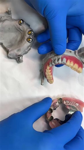 dentallab_Rock on Instagram: "Want to get a price list,please contact my WhatsApp: +86-15393729102, WhatsApp link: http://wa.me/8615393729102, our sale coworker will tell you more details, like brochure...#dentist#dentallab#teeth#denture #dentaltreatment #3Dprinter #Thefastest laboratory #crowns #Dentalimplant #Zirconiacrown #PFM #CAD #CAM"