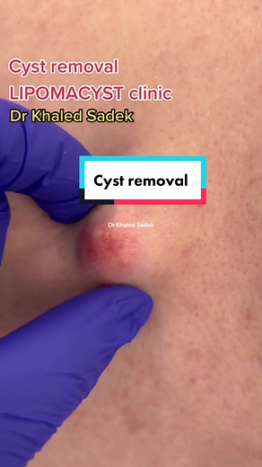Dr Khaled Sadek on TikTok