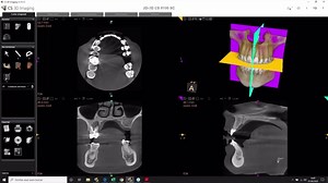 18 reactions · 3 comments | Sei possessore di un sistema CBCT Carestream Dental della linea CS 8100 3D, CS 8200 3D o CS 9600 e vuoi approfondire l’uso del software CS 3D Imaging, l’analisi di un volume 3D e indicazioni utili per ottimizzare la pianificazione dei trattamenti senza muoverti dal tuo studio odontoiatrico? Iscriviti gratuitamente al prossimo webinar: https://bit.ly/3a0utcn #carestreamdental #odontoiatriadigitale #CBCT #carestreamdentalforyou | Carestream Dental | Facebook