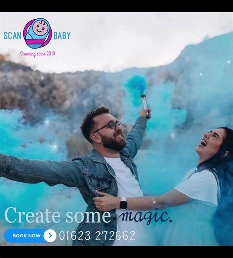 🎀💙 Ready to find out if you’re Team Pink or Team Blue?! 💙🎀 At Scan Baby, we offer gender scans from just 15 weeks💫 Watch the magic unfold on our light-up gender wall ✨ and get your adorable potty shots to cherish forever 😍📸 #GenderRevealMagic 💫 #ScanBabyExperience 👶 #TeamPinkOrBlue 💕💙 #BabyScanJourney 🍼 #ViralBabyMoment ✨