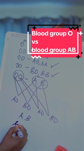 Blood Group O vs AB: Understanding Inheritance