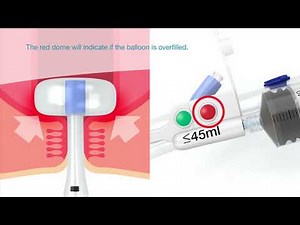 Flexi-Seal™ PROTECT FMS - Fill Protection