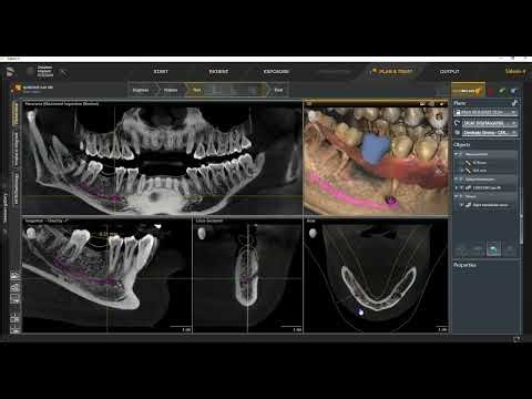 SICAT 2 0 Basic Demo