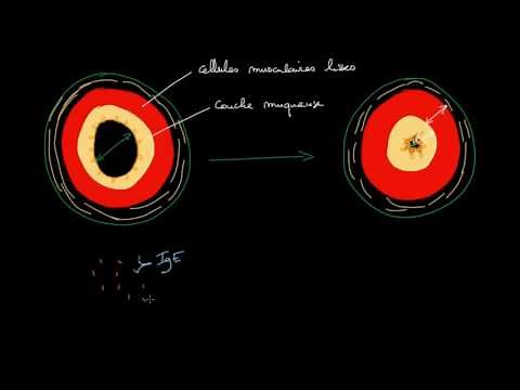 Physiopathologie de l'asthme